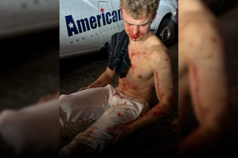 Un ex empleado de DOGE fue atacado brutalmente por menores pandilleros