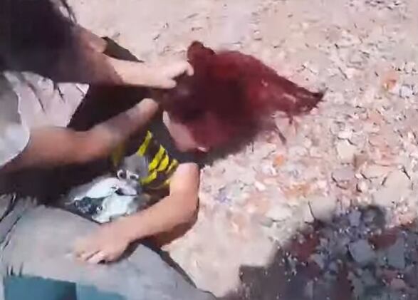 Malvinas Argentinas: familiares de una joven golpeada por dos alumnas atacaron con agua hirviendo a maestras de un colegio